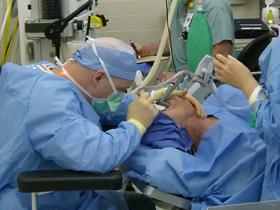 Transoral Laser Microsurgery