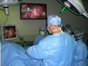 Minimally invasive weight loss procedure removes a significant portion of the stomach and restricts the amount of food that can be eaten without any bypass of the intestines.