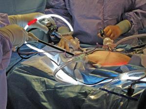 Valleylab+force+triad