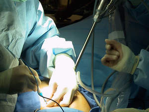 The Company's da Vinci(R) Surgical System offers surgeons superior visualization, enhanced dexterity, greater precision and ergonomic comfort for the optimal performance of MIS.
