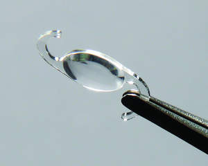 The Softec HD(TM) Intraocular Lens Implant (IOL) treats cataracts with unmatched precision and predictability. Already in widespread use internationally, the lens is now approved to treat patients in the U.S.