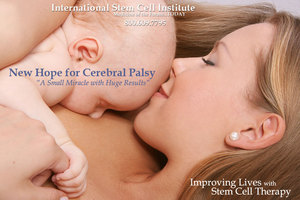 New Hope For Cerebral Palsy Patients With Stem Cell Therapy