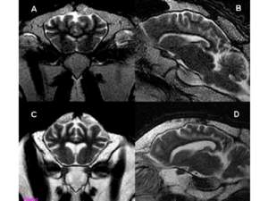 Axial and sagittal MRI images of a normal control sheep (A and B) compared to the most clinically affected animal in the study (C and D).   The sulcal prominence and enlarged lateral ventricles indicative of diffuse cerebral atrophy are seen in the scrapie affected sheep.  McKnight et al. J Transl Med 8(1):125