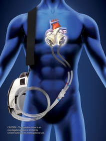 The Freedom(R) portable driver is the world's first wearable driver designed to power SynCardia's Total Artificial Heart both inside and outside the hospital.