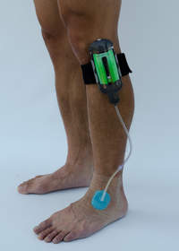 The SNaP Wound Care System in an ultraportable negative pressure wound therapy (NPWT) device that does not require power and may be worn under clothing, so it is discreet while healing chronic wounds.