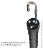 The Third Eye Retroscope from Avantis Medical Systems