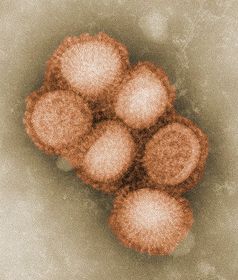 H1N1 Virus (Source: CDC)