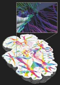 Brain Research Image