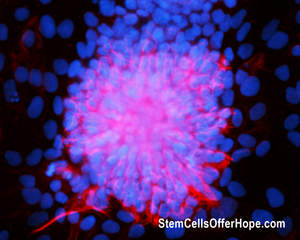 Stem Cells Offer Hope