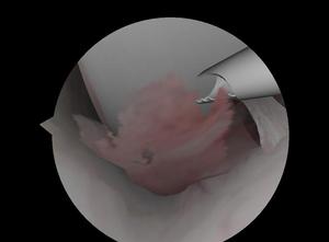 Simulator for arthroscopic surgery of the shoulder or knee