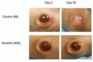 Treatment with Kevetrin significantly reduced the tumor volume by more than half in the subcutaneous tumor model and showed a significant improvement in the clarity of the eye in mice treated with Kevetrin.