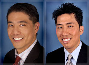 San Jose Plastic Surgeons Drs. Jerome Liu and Tom Liu