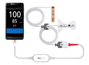 iSpO2 Rx provides accurate oxygen saturation, pulse rate and perfusion index.