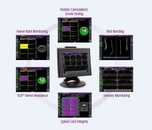 The addition of SSEPs on the NVM5(R) platform expands the reach of spine cases that NVM5 can support by offering multimodality monitoring.