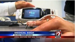 See the WKRC Cincinnati news segment featuring Dr. Mario Patino on SpHb and blood transfusions. Visit www.local12.com