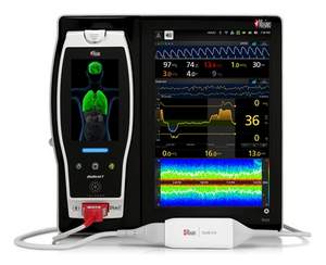 Root(R) with SedLine® brain function monitoring.